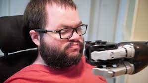 How the O540 Arm Support Has Helped Me in My Everyday Life