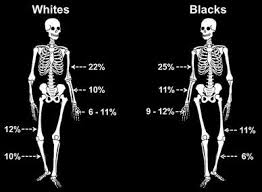 Although bones in museums are dry, hard, or crumbly, the bones in your body are different. How Does Bone Strength Compare Across Sex Site And Ethnicity Springerlink