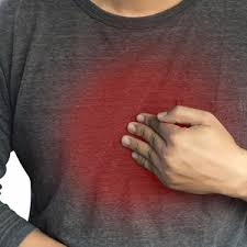 How to convince friends and family paleo will help. Take The Burn Out Of Gerd Mayo Clinic Health System