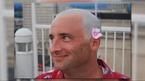 Este Hombre No Tiene Barreras Creando Conciencia Y Recaudando Fondos Contra  El Hambre Infantil