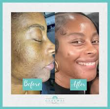 Gateway MedSpa (@gatewaymedspa) • Instagram photos and videos