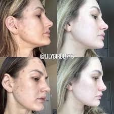 FREDDY FOX FACE TOTAL SKINCARE