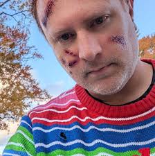 How to restore default firmware