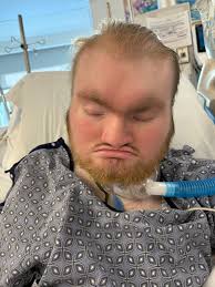 What is the best way to support a family going through a spinal cord injury  recovery?