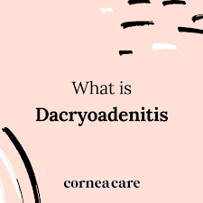 Image result for Dacryoadenitis