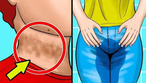 Saglik Ve Spor Aktiviteleri Panosundaki Pin