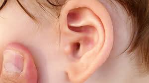 Hørselstap kan være medfødt (til stede ved fødselen) eller ervervet (til stede etter fødselsen). Har Du Et Orebarn Baby Babyverden No