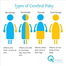Pin On Cerebral Palsy Resources