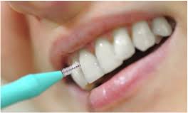 Here are our top tips for keeping your smile sparkling… avoid sugary foods and drinks. How To Clean Your Teeth At Home For The Best Oral Health Parklands Dental