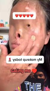 Sa dihang nakuyapan ka human ka gibanga-an... sa clinic naka nimata.Mura  sad kog nakuyapan nag tan-aw sa CCTV. Ang sakit nga imo gibati tungod sa  impact sa semento sa imong ulo maong