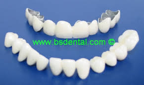 Tami dental care melayani tindakan lain yang tidak tercantum. Harga Crown Gigi Depan Klinik Kerajaan
