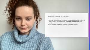 Reconstruction after Basal Cell Carcinoma Recurrence