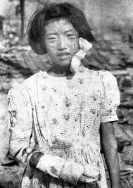 Declares war on japan then invades manchuria. Picture Of Girl Who Survived Atomic Bombing To Be Placed At Hiroshima Peace Museum The Mainichi