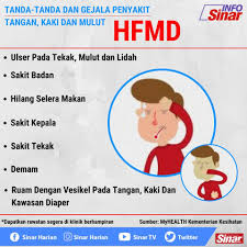 Tanda hiv yang sering dialami adalah masalah kulit. Sinar Harian Tanda Tanda Dan Gejala Hfmd Facebook