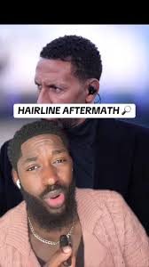 Rio Ferdinand Hair Transplant: The Amazing Hairline Aftermath