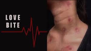 Kertas ini berbahaya dan buruk untuk kesehatan anda. How To Make Love Bite Easy Sfx Makeup Youtube