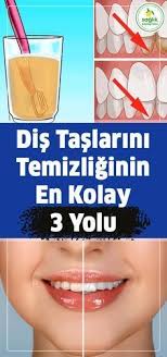 Dis Taslari Temizliginin En Kolay 3 Yolu Distaslari Kolay Pratik Saglik Health Wedding Tutorial Tutorial