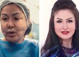 قبل ريهام سعيد.. فنانات سقطن في «فخ عمليات التجميل» (صور)