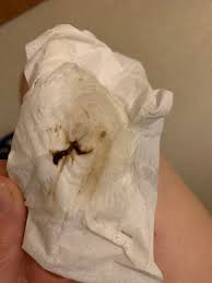 I am 10 weeks pregnant today, since thursday night i have had some brown/pink mucus when i wipe and a little bit in my knickers. 7weeks Today With This Brown Discharge Tmi Picture Included 1st Pregnancy Forums What To Expect