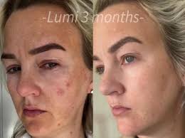 I am showing the MK Skin Care Line