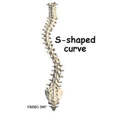 07/01/2021 ∙ by xiaoyi dong, et al. Physical Therapy In Jackson For Upper Back Pain Scoliosis