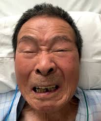 Image result for Tetanus