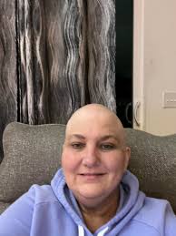 Introduction and photo sharing related to small cell lung cancer and  sublimation