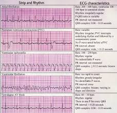 Image result for Synchronized Cardioversion