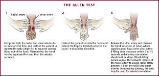 Image result for Allen Test