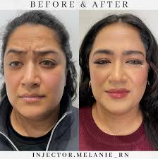 ᴍᴇʟᴀɴɪᴇ ᴛᴜᴇɴɪ ʙꜱɴ, ʀɴ