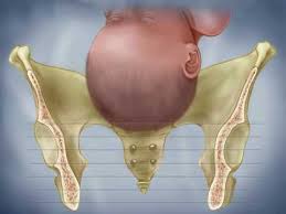 fetal descent birth station progress dilation