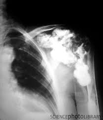 Pin By Tammy Newman On Micro Macro Anatomy Radiology Imaging Bone Diseases Radiology