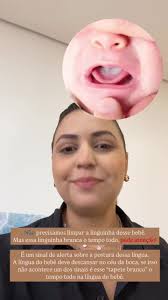 A Lingua Do Meu Bebe Não Chega No Ceu Da Boca É Normal