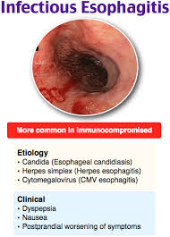 Esophagitis may cause odynophagia and even esophageal hemorrhage, which is usually occult but can be massive. Rosh Review Medical Therapy Gastrointestinal Nursing Naturopathic Medicine