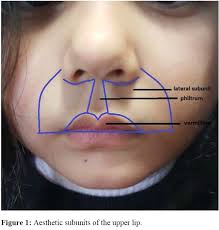 Image result for Hypolytrum