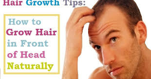In the most common type of hair loss, inherited hair loss (androgenetic alopecia), men tend to lose hair on the front hairline and forehead and on top of the head. Hair Growth Tips How To Grow Hair In Front Of Head Naturally The Scientific World Let S Have A Moment Of Science