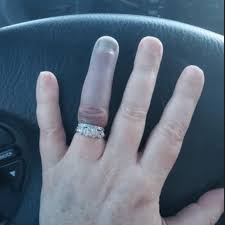 فى مواجهة البحرالابيض المتوسط شجرة الصنوبر In What Finger Is The Wedding Ring Psidiagnosticins Com