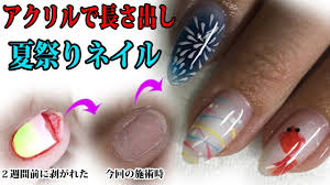 アクリルで長さ出し夏祭りジェルネイルデザイン爪が剥がれてから２週間後