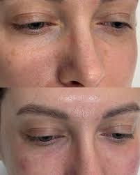 ℂ𝕠𝕤𝕞𝕖𝕥𝕠𝕝𝕠𝕘𝕪 🤍 (@dr.dianaesthet) • Instagram photos and videos