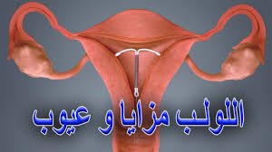 اللولب الرحمي من اكثر وسائل منع الحمل فعالية ونتائجه اكيدة ومضمونة، وهو. ÙˆØ³Ø§Ø¦Ù„ Ù…Ù†Ø¹ Ø§Ù„Ø­Ù…Ù„ Ø£Ù†ÙˆØ§Ø¹Ù‡Ø§ ÙˆÙ…Ù…ÙŠØ²Ø§ØªÙ‡Ø§ ÙˆØ¹ÙŠÙˆØ¨Ù‡Ø§ Ø¬3 Ø§Ù„Ù„ÙˆÙ„Ø¨ Ø§Ùˆ Ø§Ù„Ø´Ø±ÙŠØ· Youtube