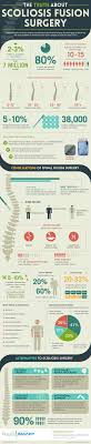 The Truth About Scoliosis Fusion Surgery Scoliosis Scoliosis Treatment Scoliosis Surgery