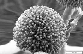Aspergillus niger is the most common species of aspergillus. Aspergillus Endangers Children At Hospital For Second Time This Year
