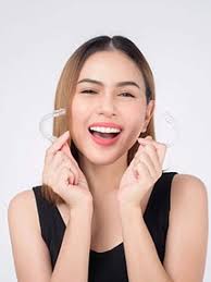 Invisalign Braces in Milton & Oakville