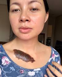 Selfies with the biggest scab of my life 😆 but seriously, thank You God  for healing me 🙏🏼🤍