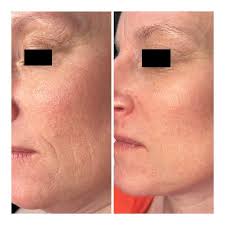 Perri Johnsen (@skinbyperrijohnsen) • Instagram photos and videos