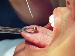 Piercings Im Mund Konnen Infektionen Nach Sich Ziehen Berlin De