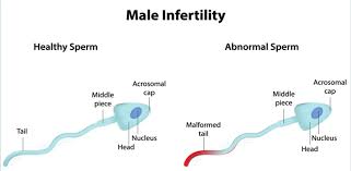 Brand new fresh ayurvedic products of the most popular, trusted and authentic brands. Male Infertility Dr Chanchal Sharma