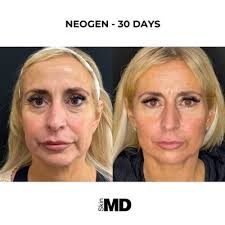 TOP 10 BEST Graston Technique in Manchester, NH