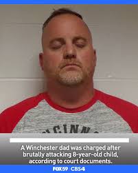 A Winchester dad was charged after allegedly beating his son. More here:  https://fox59.com/news/indycrime/docs-winchester-dad-arrested-for-brutally-beating-8-year-old-son/