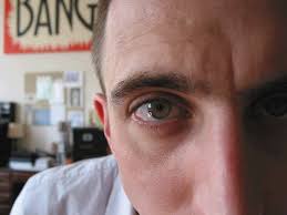 Namun dalam kacamata medis, mata kedutan sebelah kanan umum sering dijumpai dan biasanya tidak berbahaya. Kelopak Mata Kiri Atau Kanan Bergerak Eratuku